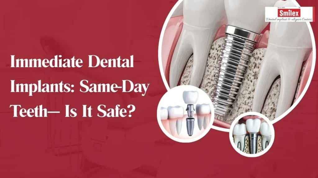 Immediate Dental Implants Same-Day Teeth Is It Safe? smilex blog 1 (4)