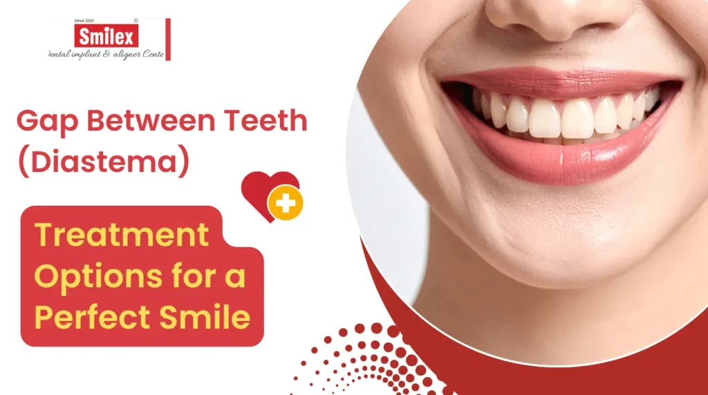 Gap Between Teeth (Diastema) Treatment Options for a Perfect Smile smilex blog 17