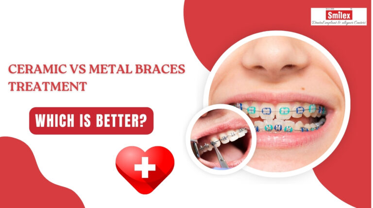ceramic vs metal braces treatment in pune 2.jpg 1