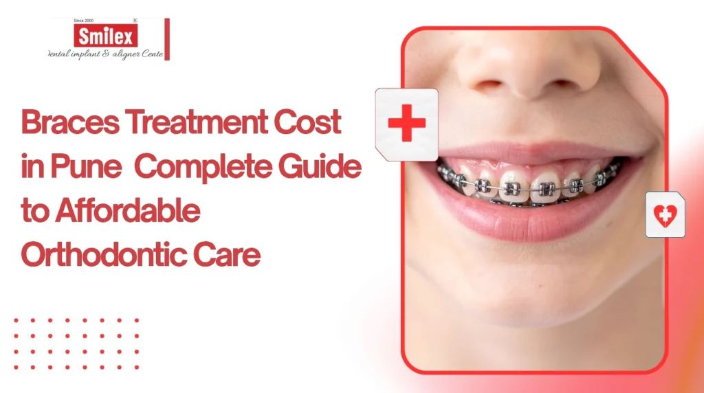Braces Treatment Cost in Pune Complete Guide to Affordable Orthodontic Care smilex .jpg