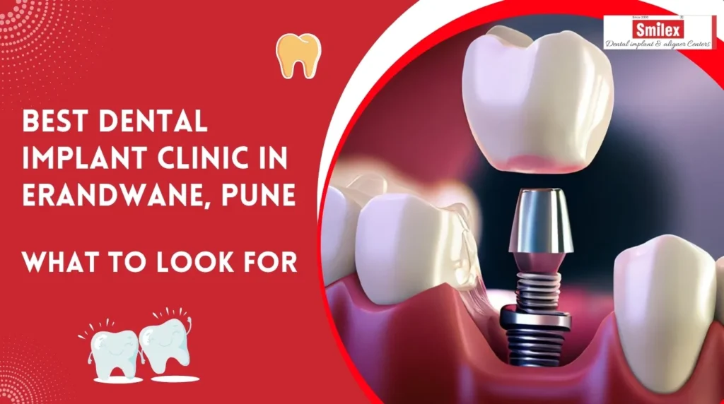 Best Dental Implant Clinic in Erandwane, Pune | What to Look For best dental implant clinic in erandwane pune what to look for.jpg