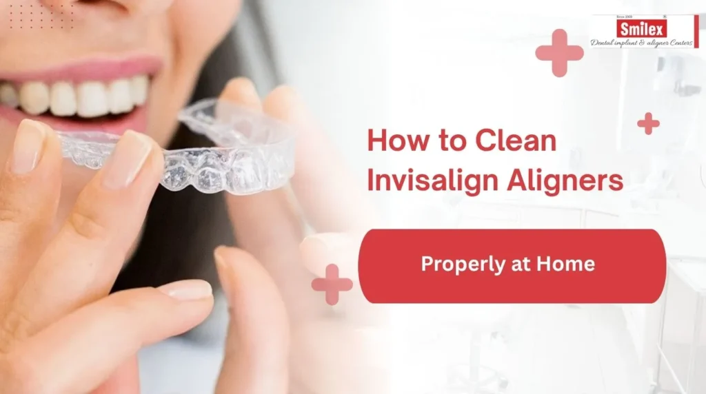 How to Clean Invisalign Aligners Properly at Home how to clean invisalign aligners properly at home.jpg 1
