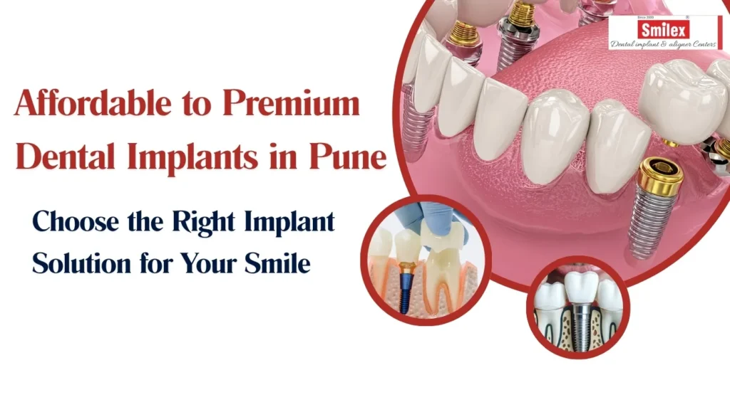 Affordable to Premium Dental Implants in Pune | Choose the Right Implant Solution for Your Smile smilex blog 2.jpg