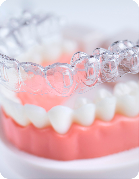 clear aligners