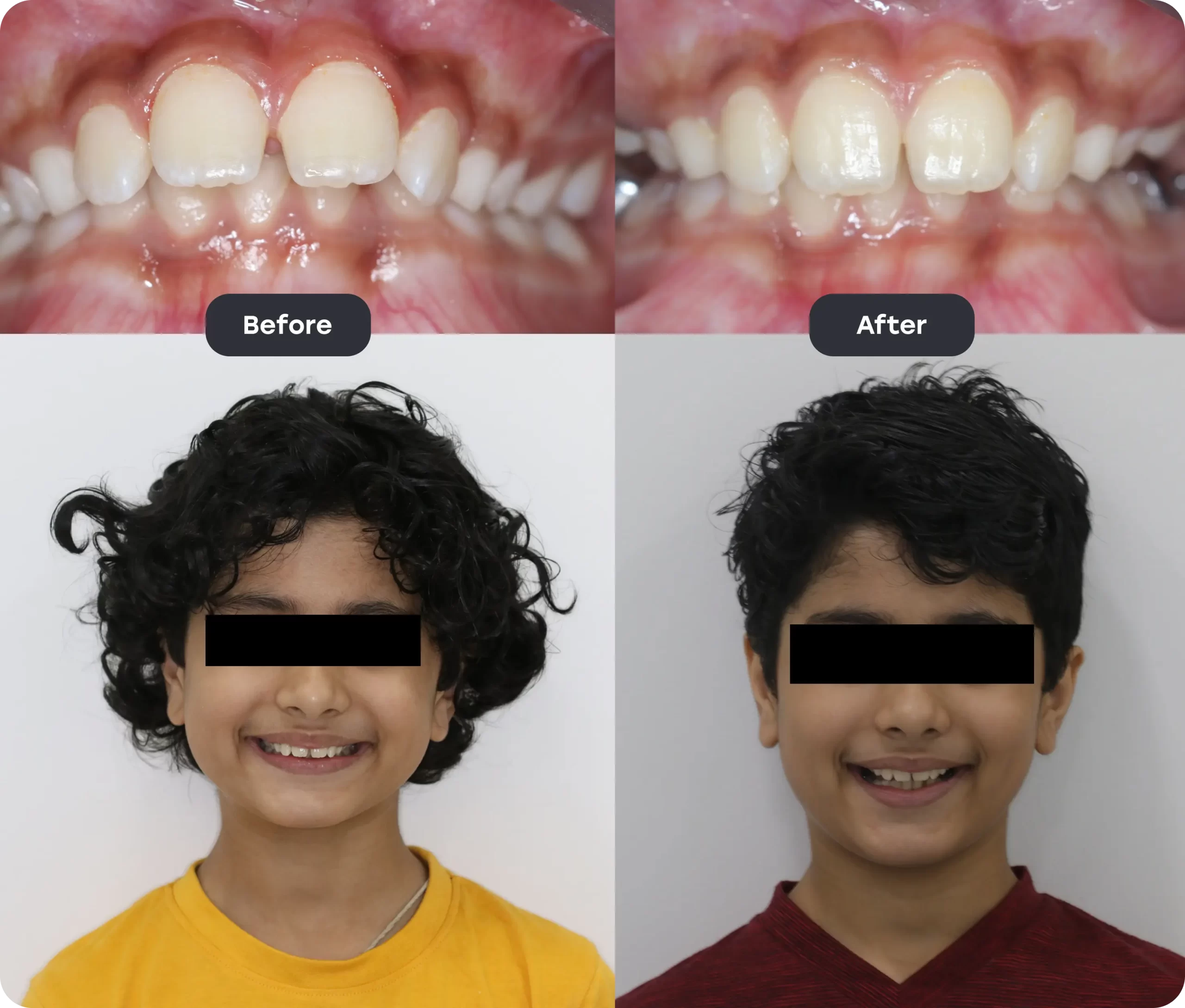 before after new2 scaled