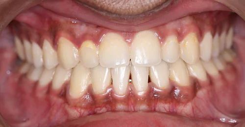 case1 after 1