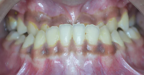 case1 before 2