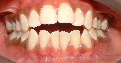 case4 before
