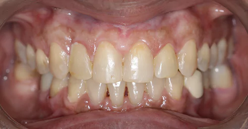 case5 after